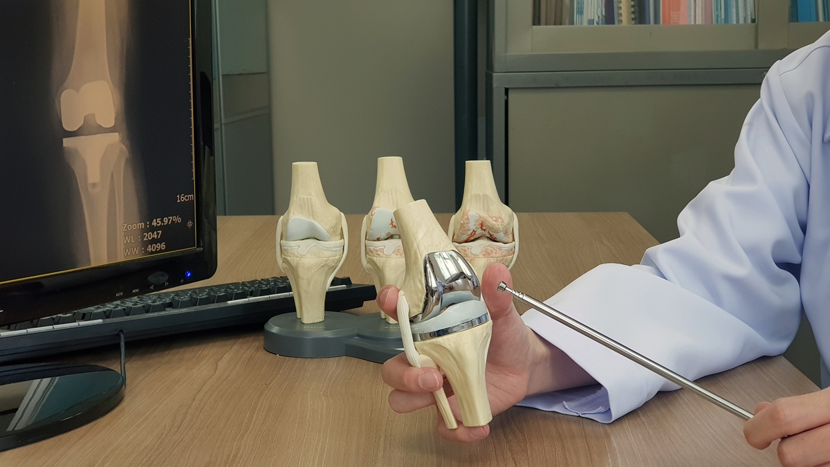 doctor showing components of artificial knee