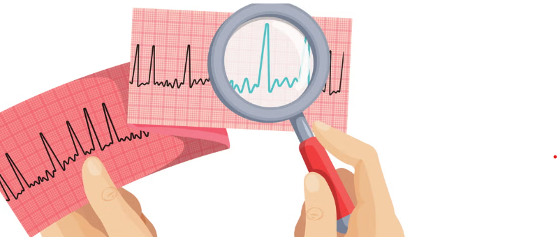 Heart Rhythm Chart with Magnifying Glass
