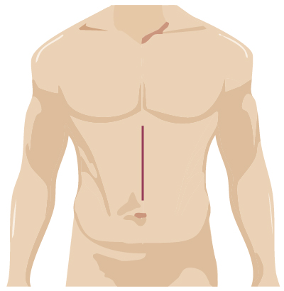 surgery